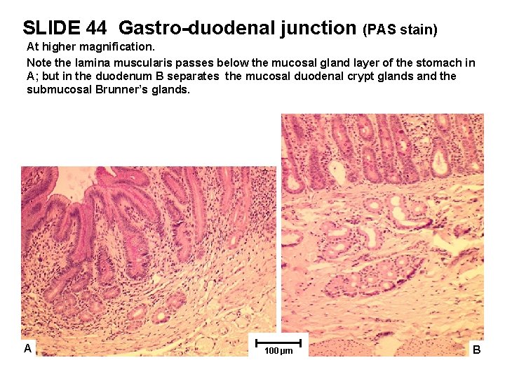 SLIDE 44 Gastro-duodenal junction (PAS stain) At higher magnification. Note the lamina muscularis passes