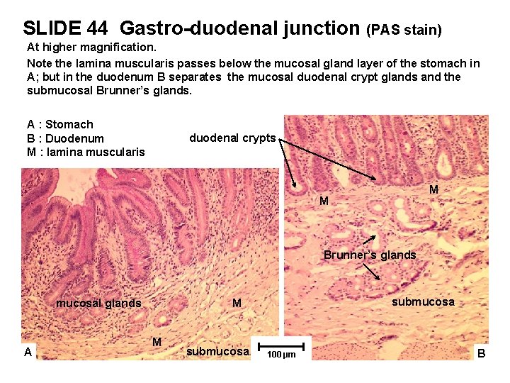 SLIDE 44 Gastro-duodenal junction (PAS stain) At higher magnification. Note the lamina muscularis passes