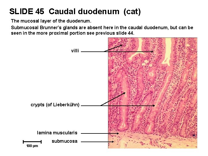 SLIDE 45 Caudal duodenum (cat) The mucosal layer of the duodenum. Submucosal Brunner’s glands