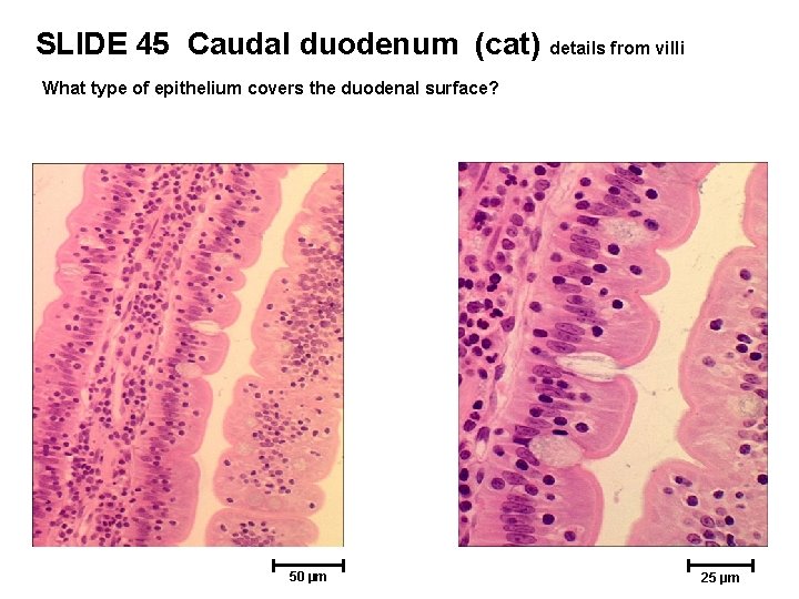 SLIDE 45 Caudal duodenum (cat) details from villi What type of epithelium covers the