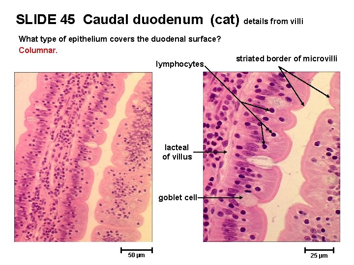 SLIDE 45 Caudal duodenum (cat) details from villi What type of epithelium covers the