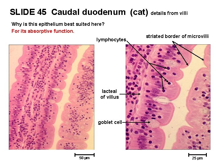 SLIDE 45 Caudal duodenum (cat) details from villi Why is this epithelium best suited