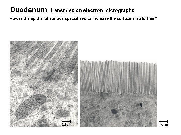 Duodenum transmission electron micrographs How is the epithelial surface specialised to increase the surface