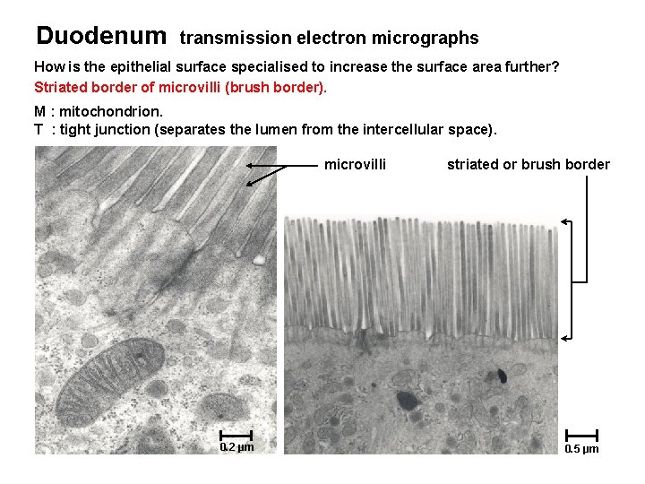 Duodenum transmission electron micrographs How is the epithelial surface specialised to increase the surface