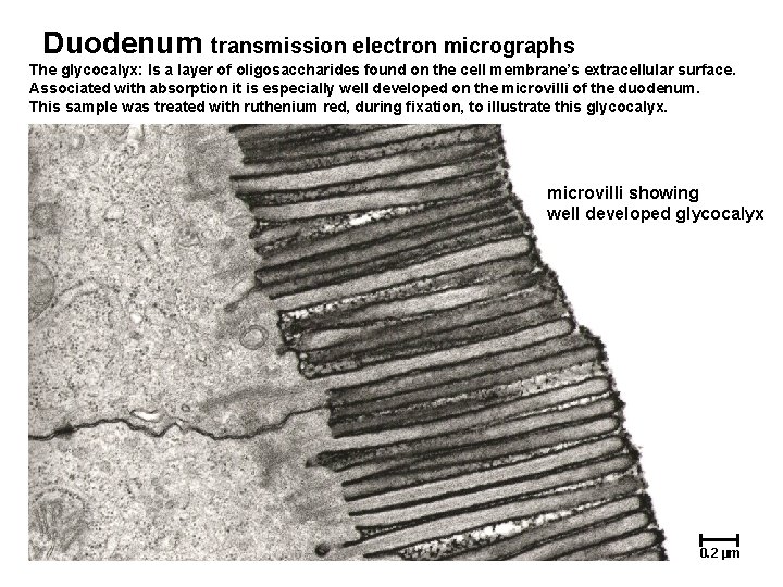 Duodenum transmission electron micrographs The glycocalyx: Is a layer of oligosaccharides found on the