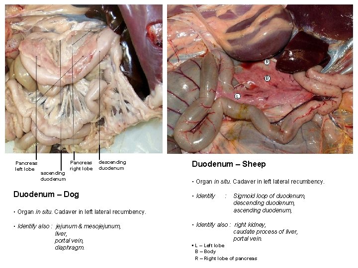 R B L Pancreas left lobe ascending duodenum Pancreas right lobe descending duodenum Duodenum