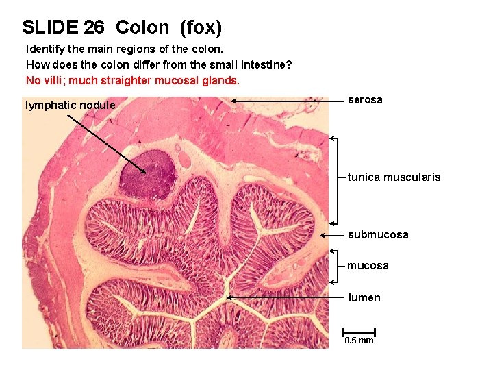 SLIDE 26 Colon (fox) Identify the main regions of the colon. How does the