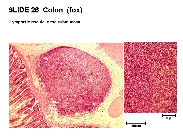 SLIDE 26 Colon (fox) Lymphatic nodule in the submucosa. 50 µm 250 µm 