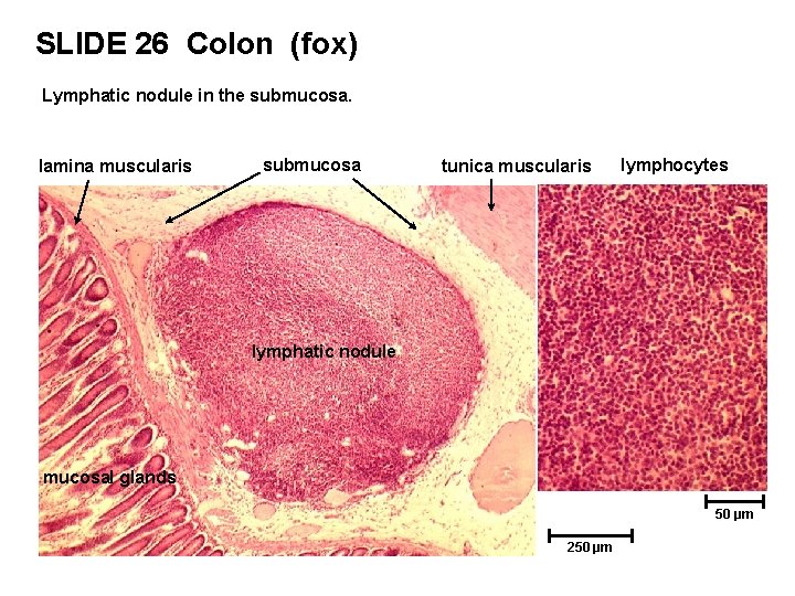 SLIDE 26 Colon (fox) Lymphatic nodule in the submucosa. lamina muscularis submucosa tunica muscularis