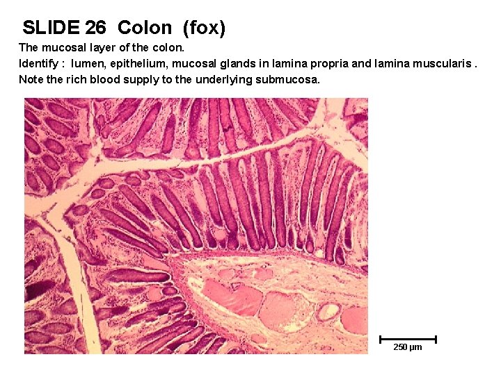 SLIDE 26 Colon (fox) The mucosal layer of the colon. Identify : lumen, epithelium,