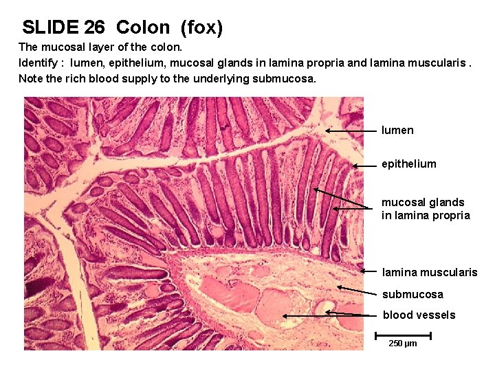 SLIDE 26 Colon (fox) The mucosal layer of the colon. Identify : lumen, epithelium,