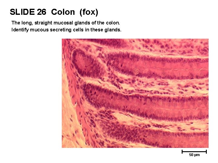 SLIDE 26 Colon (fox) The long, straight mucosal glands of the colon. Identify mucous