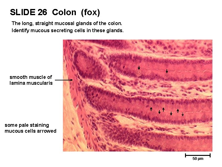 SLIDE 26 Colon (fox) The long, straight mucosal glands of the colon. Identify mucous