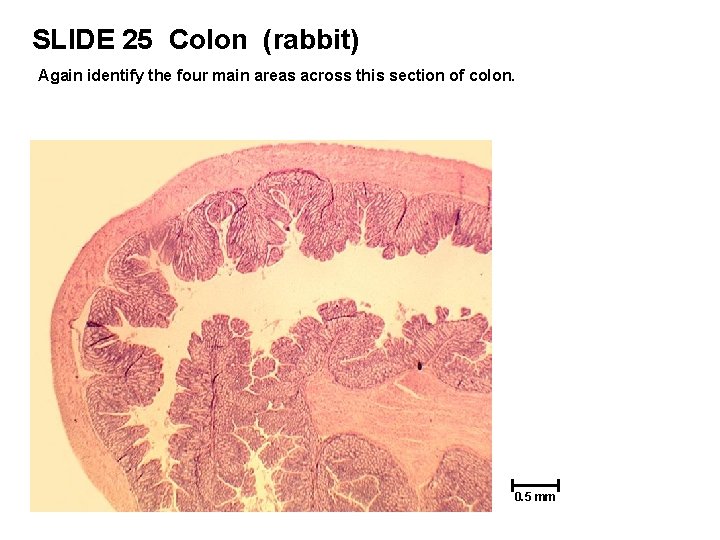 SLIDE 25 Colon (rabbit) Again identify the four main areas across this section of