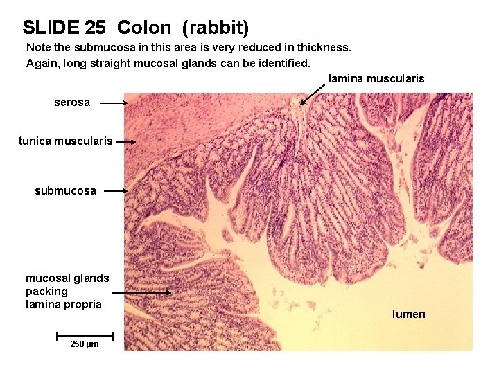 SLIDE 25 Colon (rabbit) Note the submucosa in this area is very reduced in