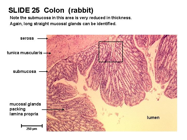 SLIDE 25 Colon (rabbit) Note the submucosa in this area is very reduced in