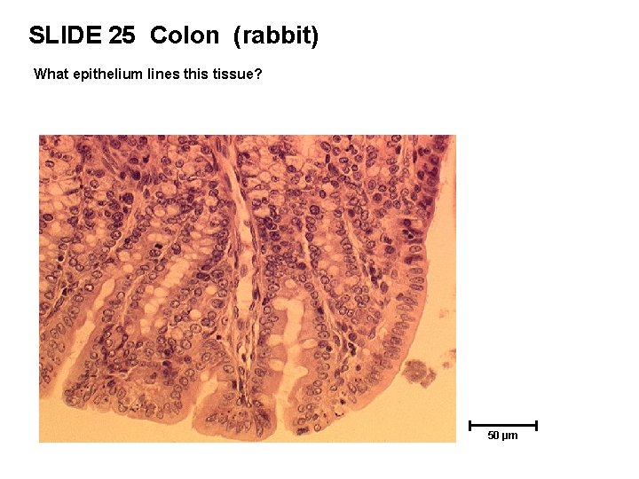 SLIDE 25 Colon (rabbit) What epithelium lines this tissue? 50 µm 