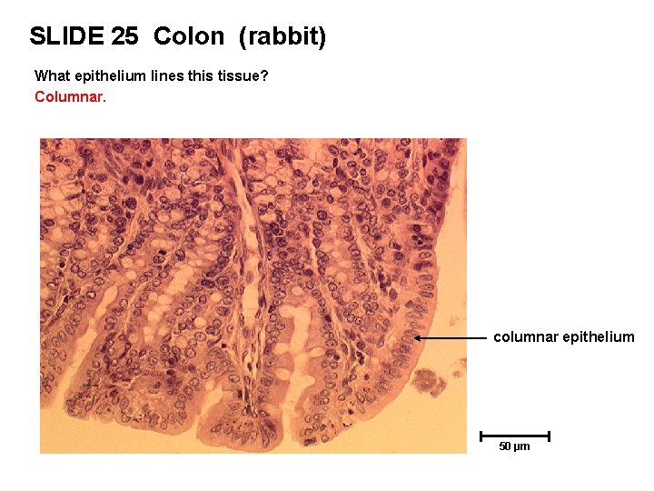 SLIDE 25 Colon (rabbit) What epithelium lines this tissue? Columnar. columnar epithelium 50 µm