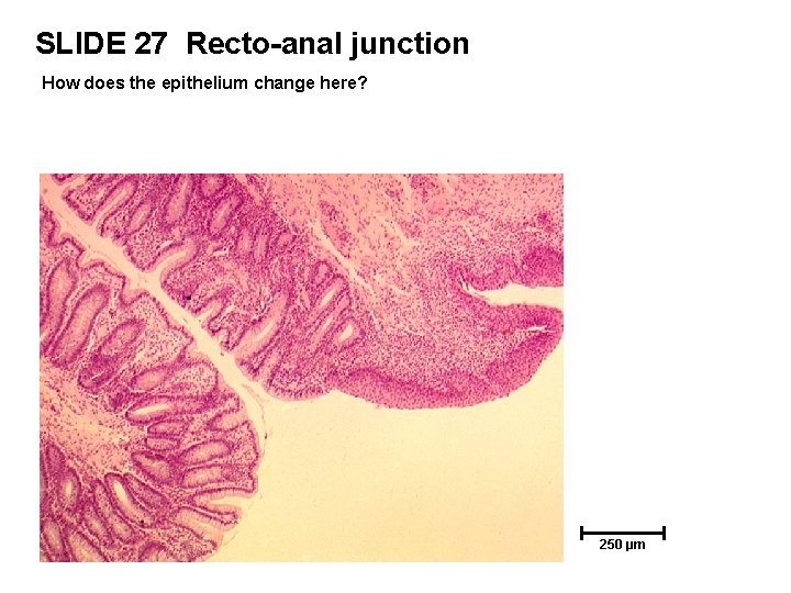 SLIDE 27 Recto-anal junction How does the epithelium change here? 250 µm 