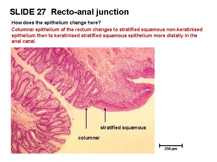 SLIDE 27 Recto-anal junction How does the epithelium change here? Columnar epithelium of the