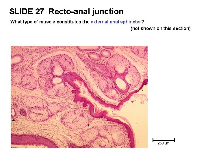 SLIDE 27 Recto-anal junction What type of muscle constitutes the external anal sphincter? (not