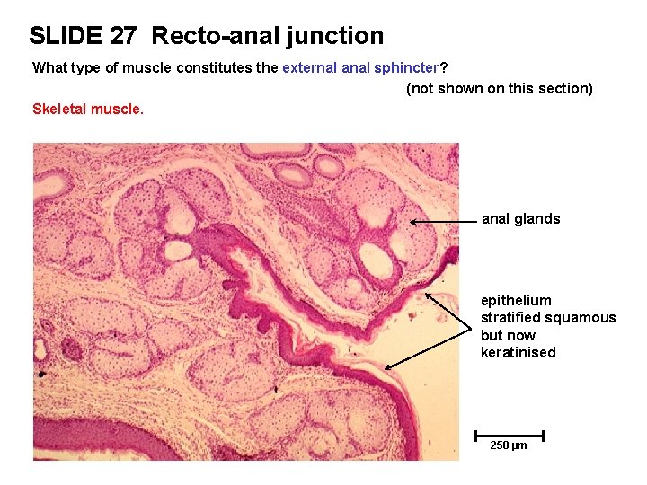 SLIDE 27 Recto-anal junction What type of muscle constitutes the external anal sphincter? (not