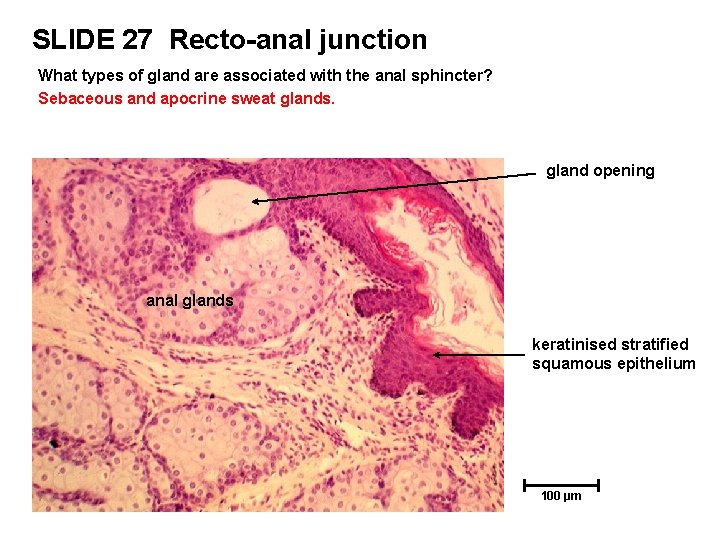 SLIDE 27 Recto-anal junction What types of gland are associated with the anal sphincter?