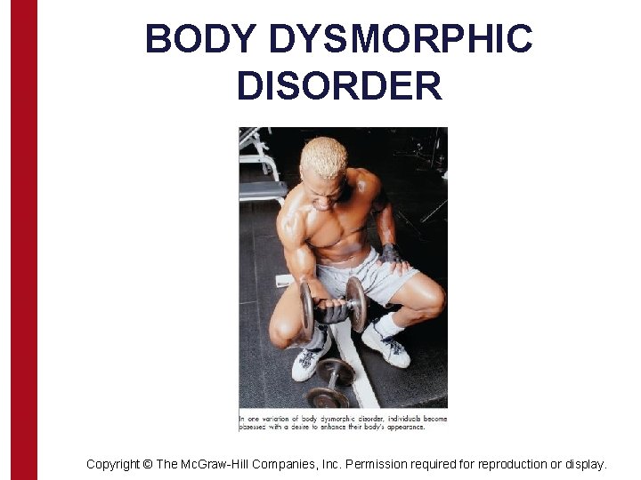 BODY DYSMORPHIC DISORDER Copyright © The Mc. Graw-Hill Companies, Inc. Permission required for reproduction