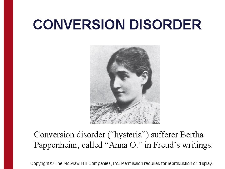 CONVERSION DISORDER Conversion disorder (“hysteria”) sufferer Bertha Pappenheim, called “Anna O. ” in Freud’s