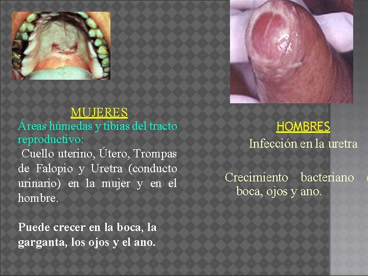 MUJERES Áreas húmedas y tibias del tracto reproductivo: Cuello uterino, Útero, Trompas de Falopio