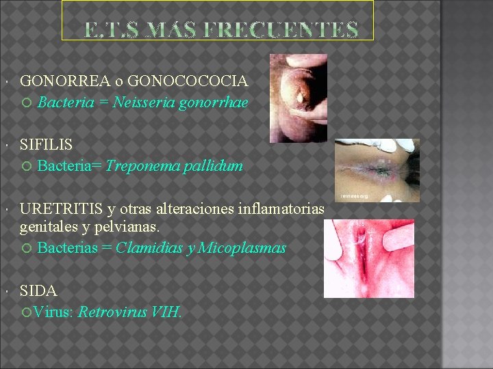  GONORREA o GONOCOCOCIA Bacteria = Neisseria gonorrhae SIFILIS Bacteria= Treponema pallidum URETRITIS y