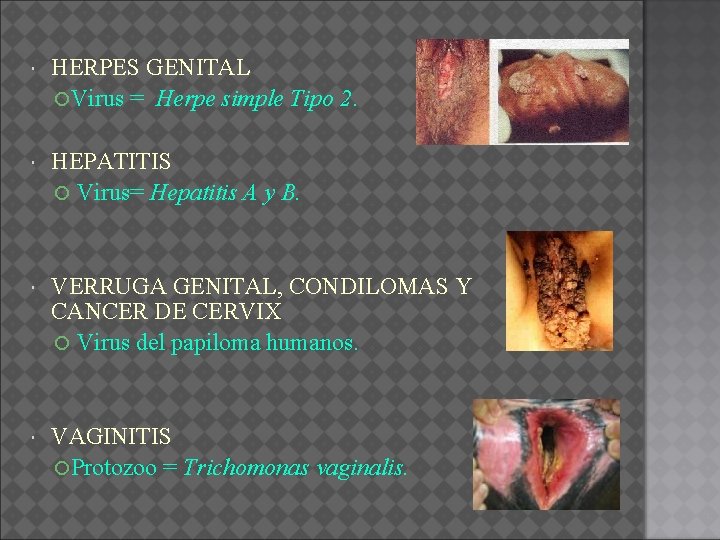  HERPES GENITAL Virus = Herpe simple Tipo 2. HEPATITIS Virus= Hepatitis A y