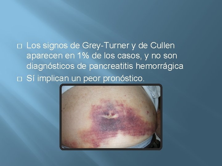 � � Los signos de Grey-Turner y de Cullen aparecen en 1% de los