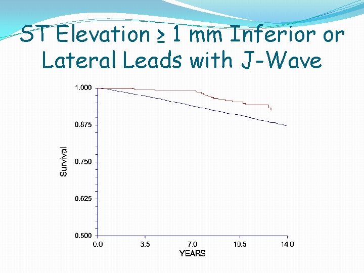 ST Elevation ≥ 1 mm Inferior or Lateral Leads with J-Wave ST Elevation ≥ 1 mm Inferior or Lateral Leads with J-Wave