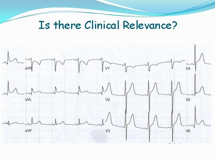 Is there Clinical Relevance? Is there Clinical Relevance?