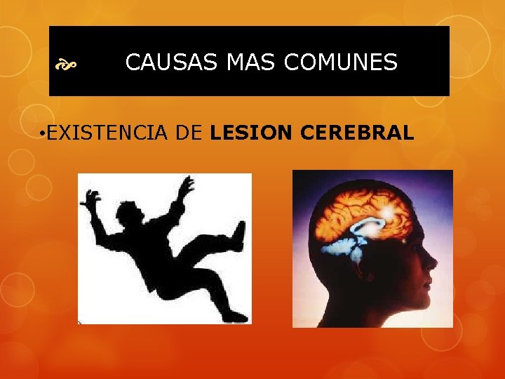  CAUSAS MAS COMUNES • EXISTENCIA DE LESION CEREBRAL 