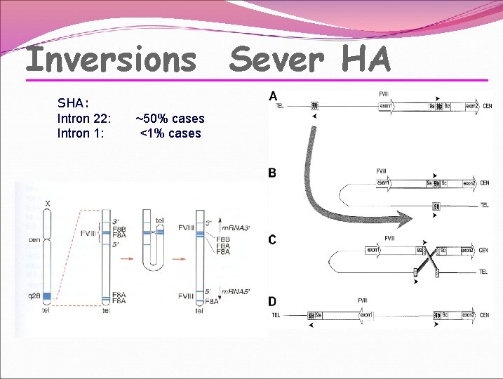 Inversions Sever HA SHA: Intron 22: Intron 1: ~50% cases <1% cases 