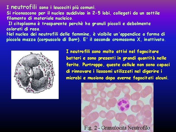 I neutrofili sono i leucociti più comuni. Si riconoscono per il nucleo suddiviso in