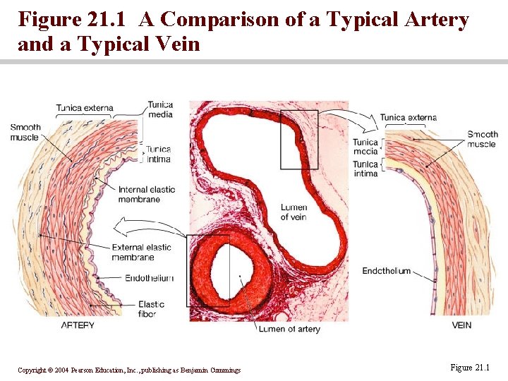 Figure 21. 1 A Comparison of a Typical Artery and a Typical Vein Copyright