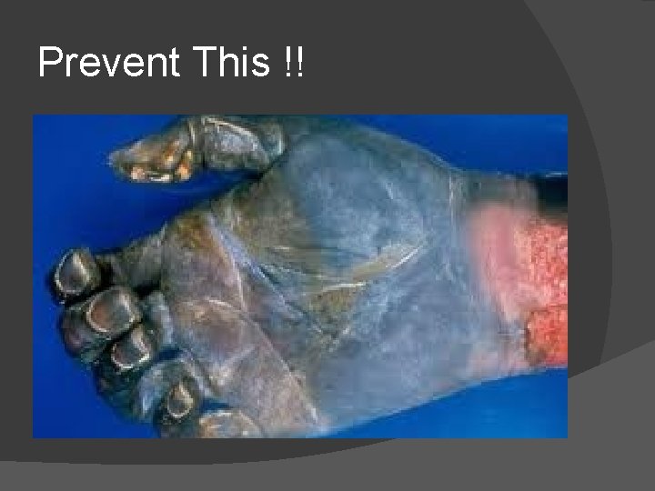 Prevent This !! 
