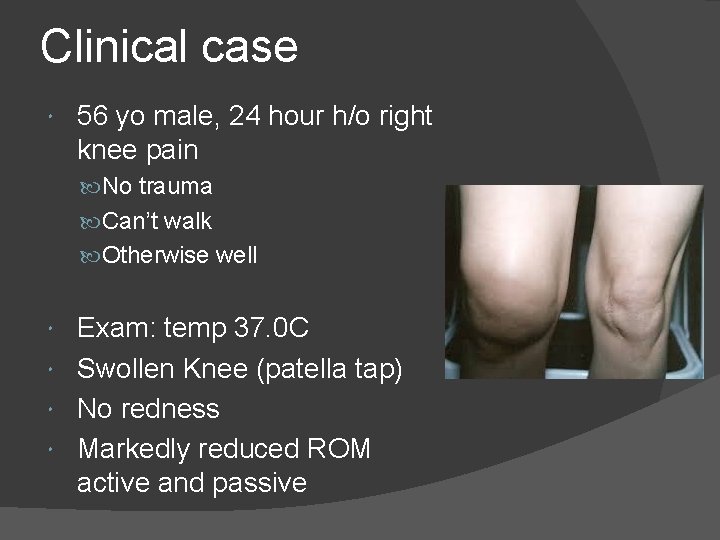 Clinical case 56 yo male, 24 hour h/o right knee pain No trauma Can’t