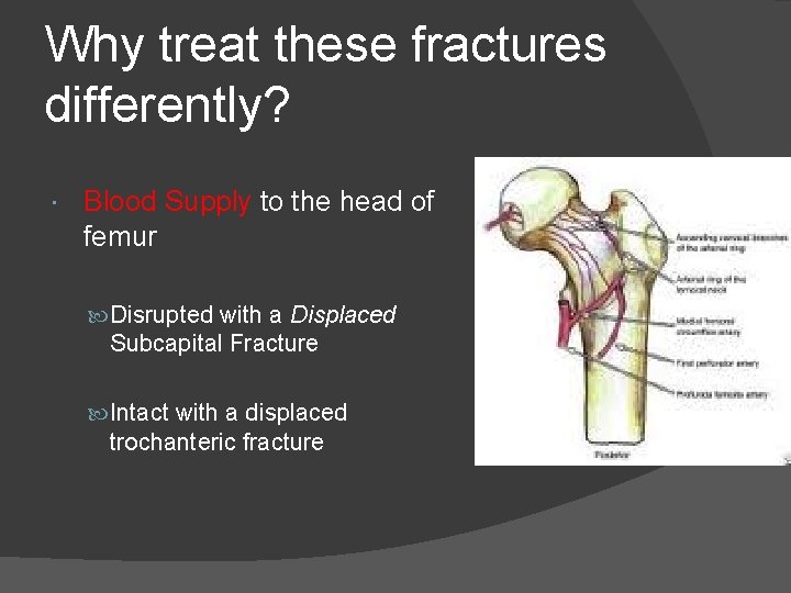 Why treat these fractures differently? Blood Supply to the head of femur Disrupted with