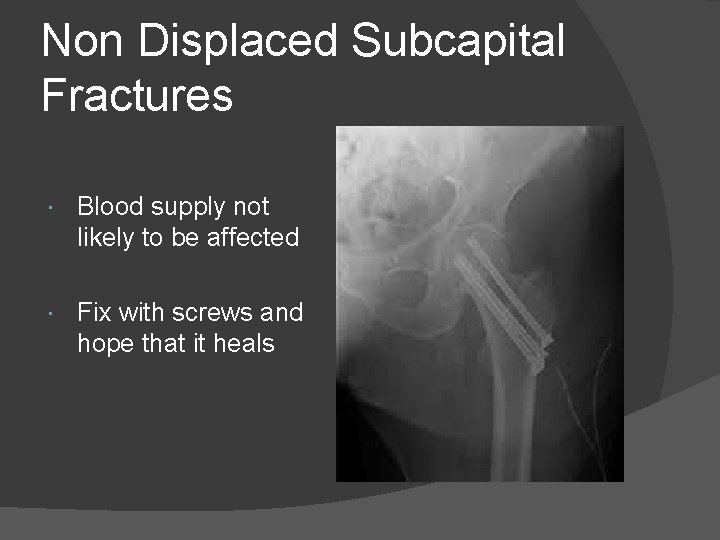 Non Displaced Subcapital Fractures Blood supply not likely to be affected Fix with screws
