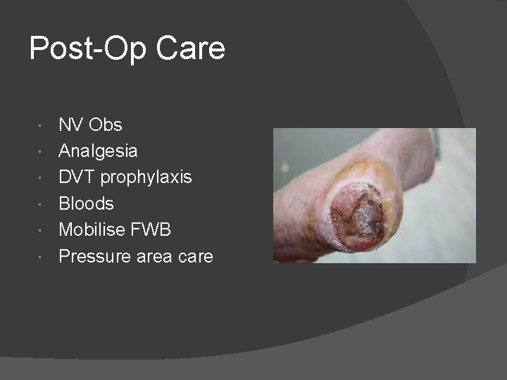 Post-Op Care NV Obs Analgesia DVT prophylaxis Bloods Mobilise FWB Pressure area care 