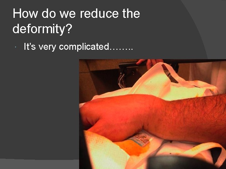 How do we reduce the deformity? It’s very complicated……. . 