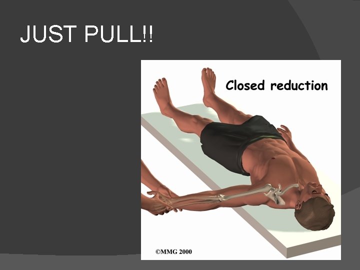 JUST PULL!! 