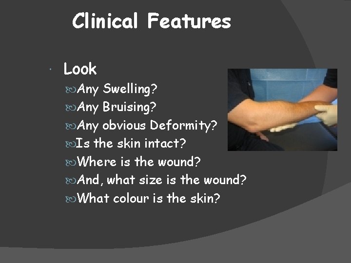 Clinical Features Look Any Swelling? Any Bruising? Any obvious Deformity? Is the skin intact?