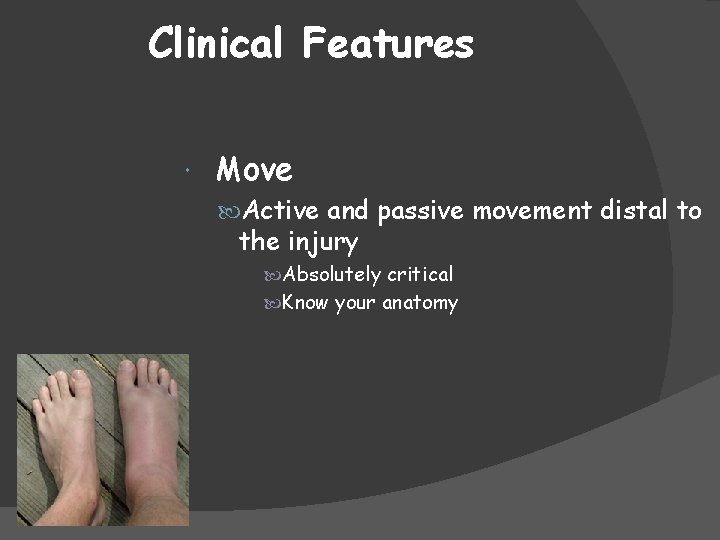 Clinical Features Move Active and passive movement distal to the injury Absolutely critical Know