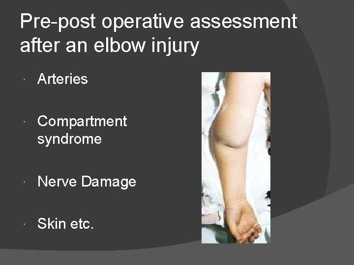 Pre-post operative assessment after an elbow injury Arteries Compartment syndrome Nerve Damage Skin etc.