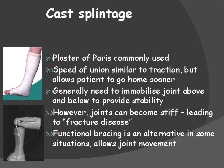 Cast splintage Plaster of Paris commonly used Speed of union similar to traction, but
